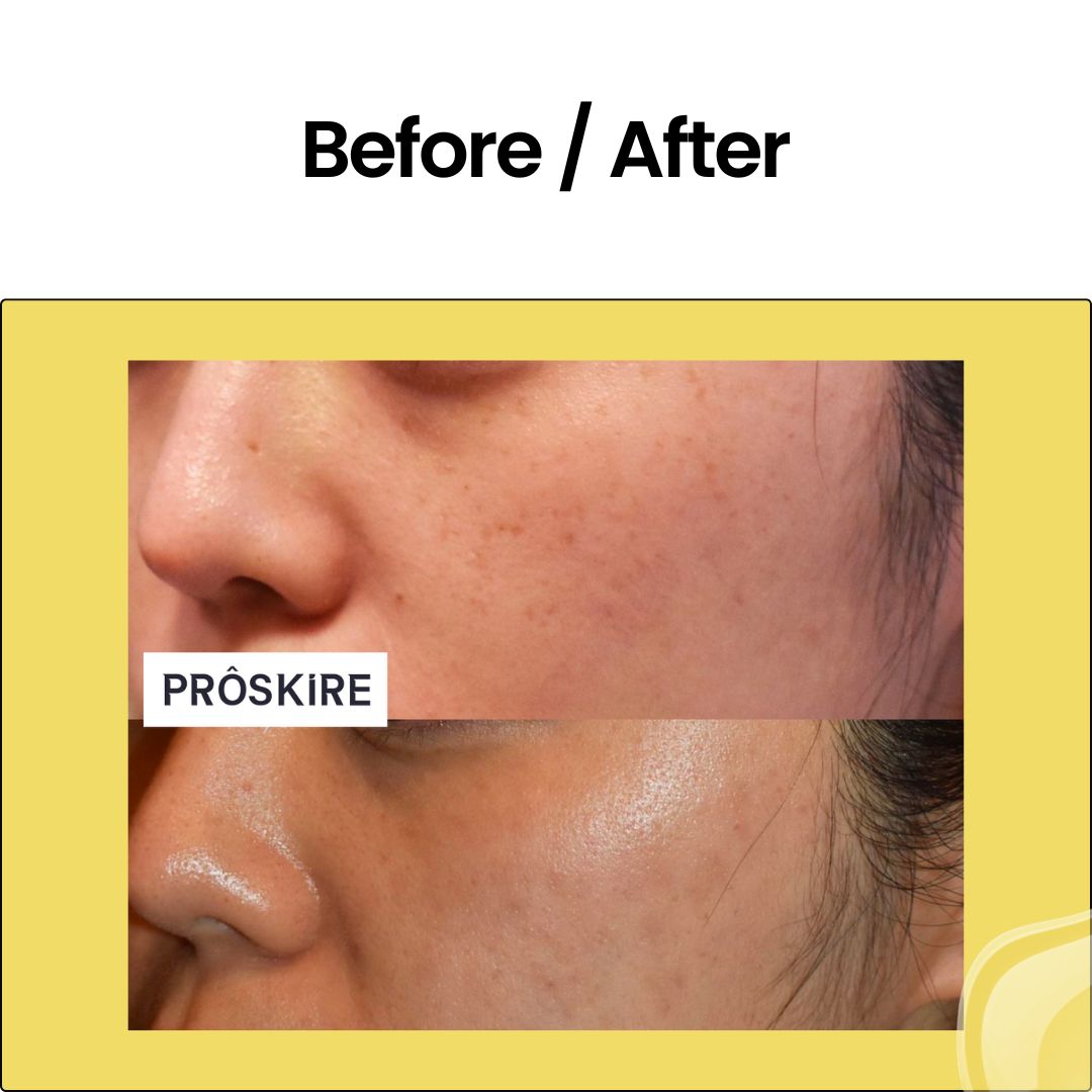 Advance Vitamin C Serum For Pigmentation and Clear Skin
