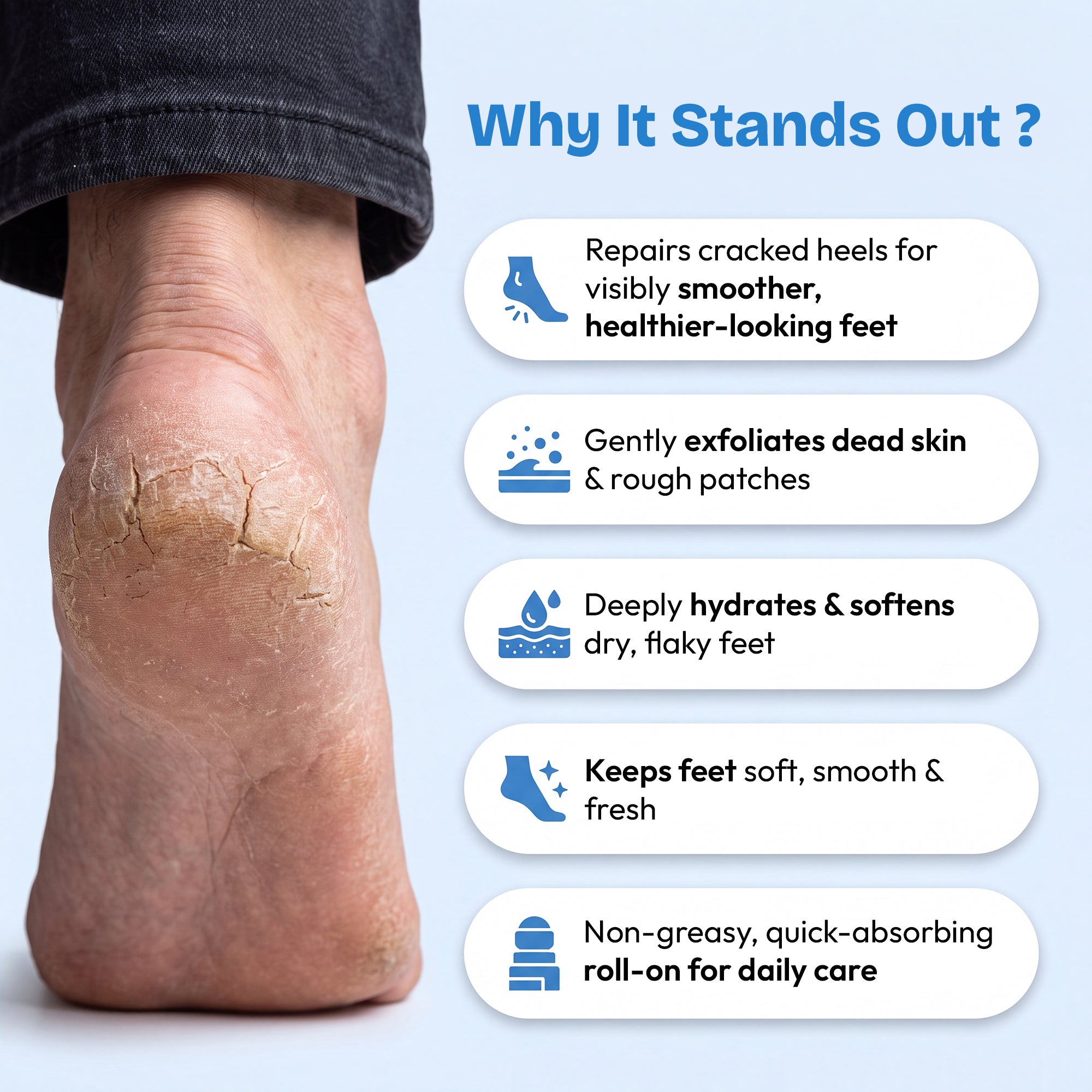 Proskire 20% Urea Foot Cream Roll-On 50ml