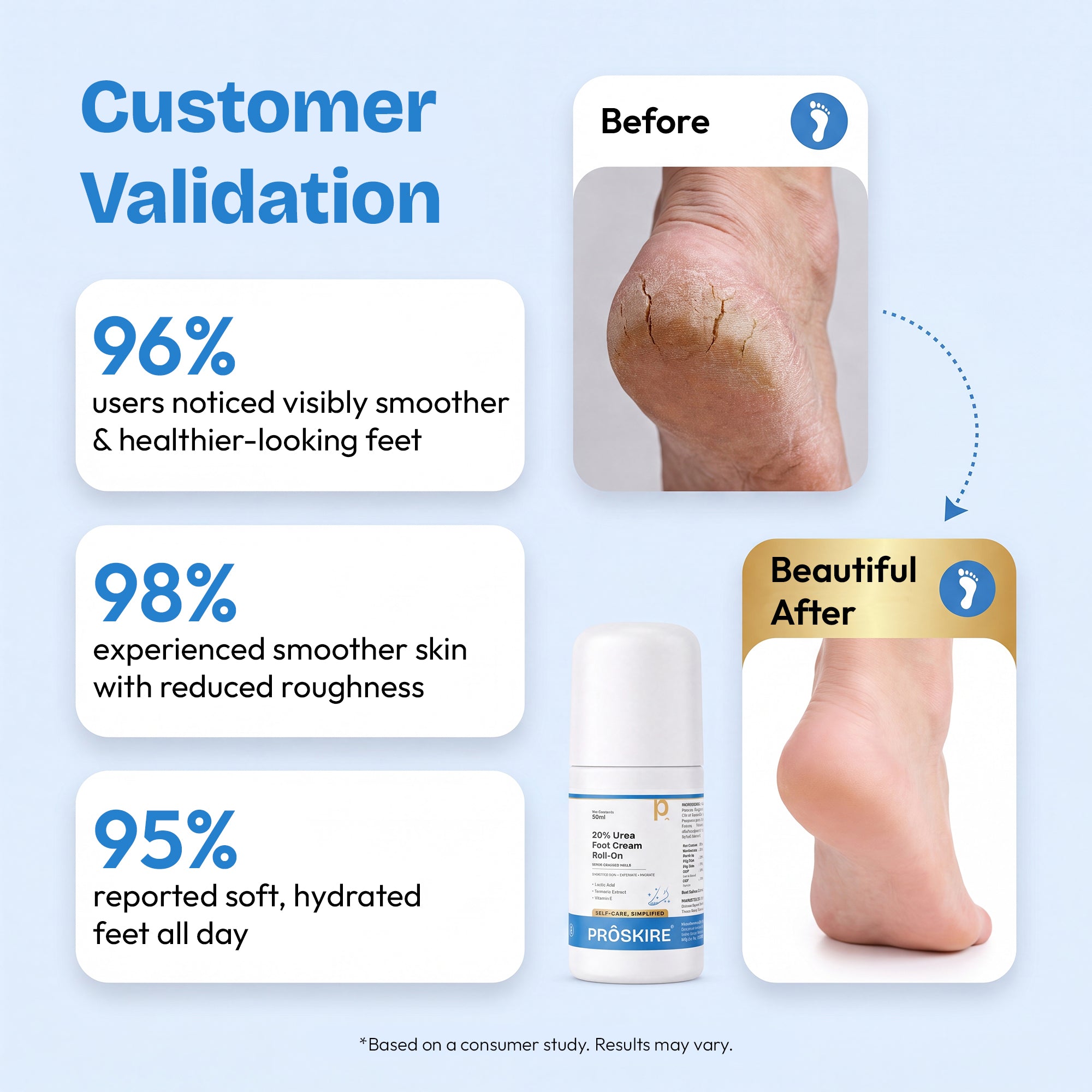 Proskire 20% Urea Foot Cream Roll-On 50ml