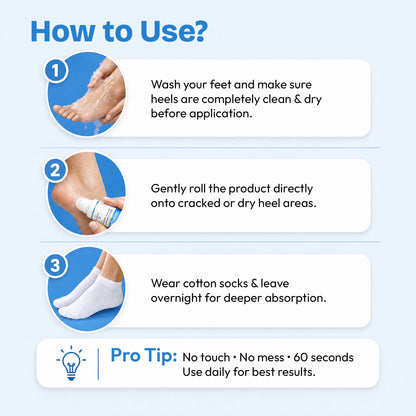Proskire 20X Urea Foot Cream Roll-On 50ml