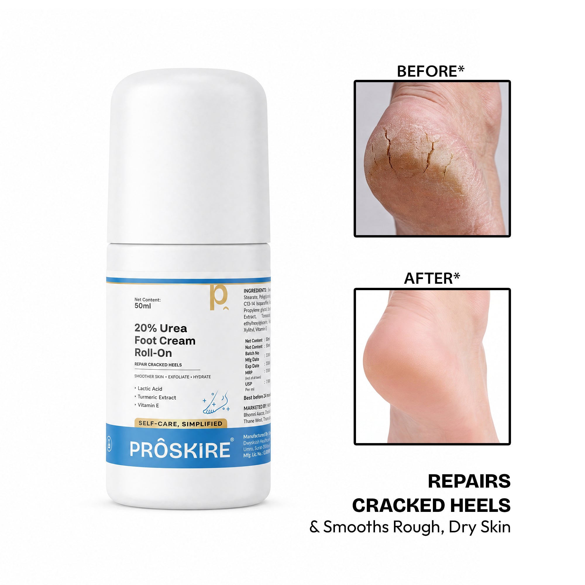 Proskire 20% Urea Foot Cream Roll-On 50ml