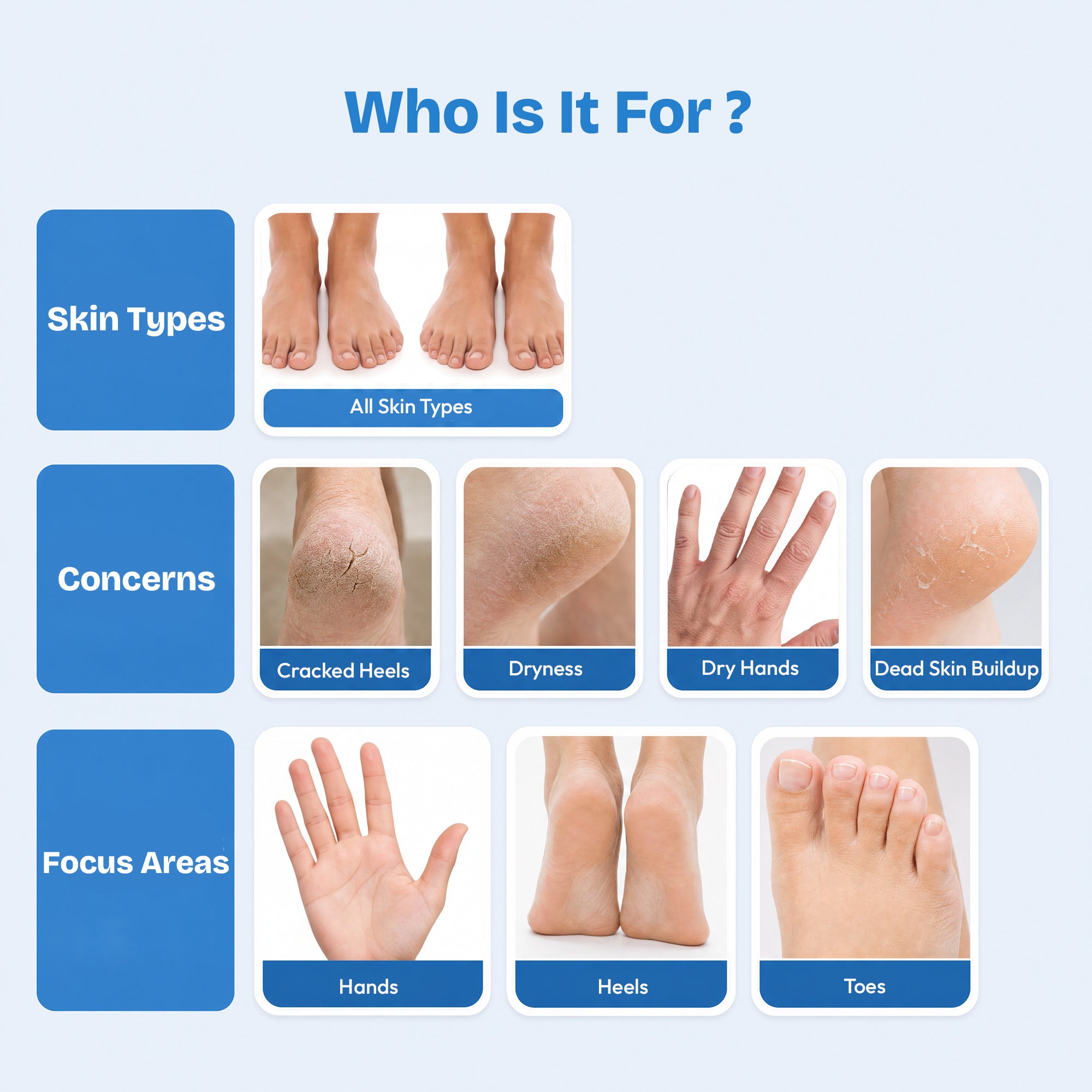 Proskire 20% Urea Foot Cream Roll-On 50ml