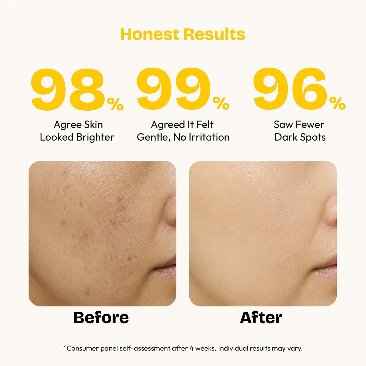 Advance Vitamin C Serum 30ml