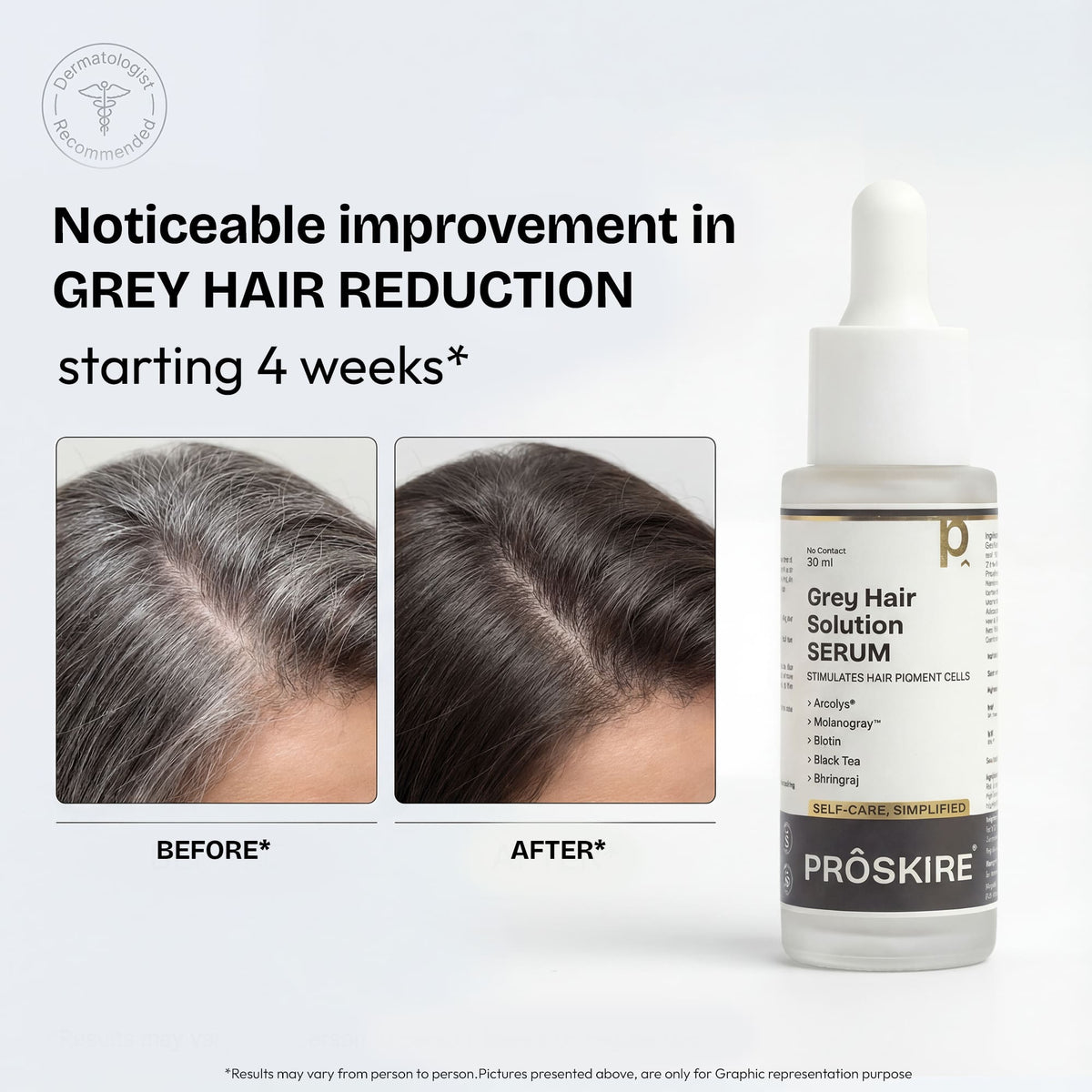 Grey Hair Solution Serum 30ml — 3
