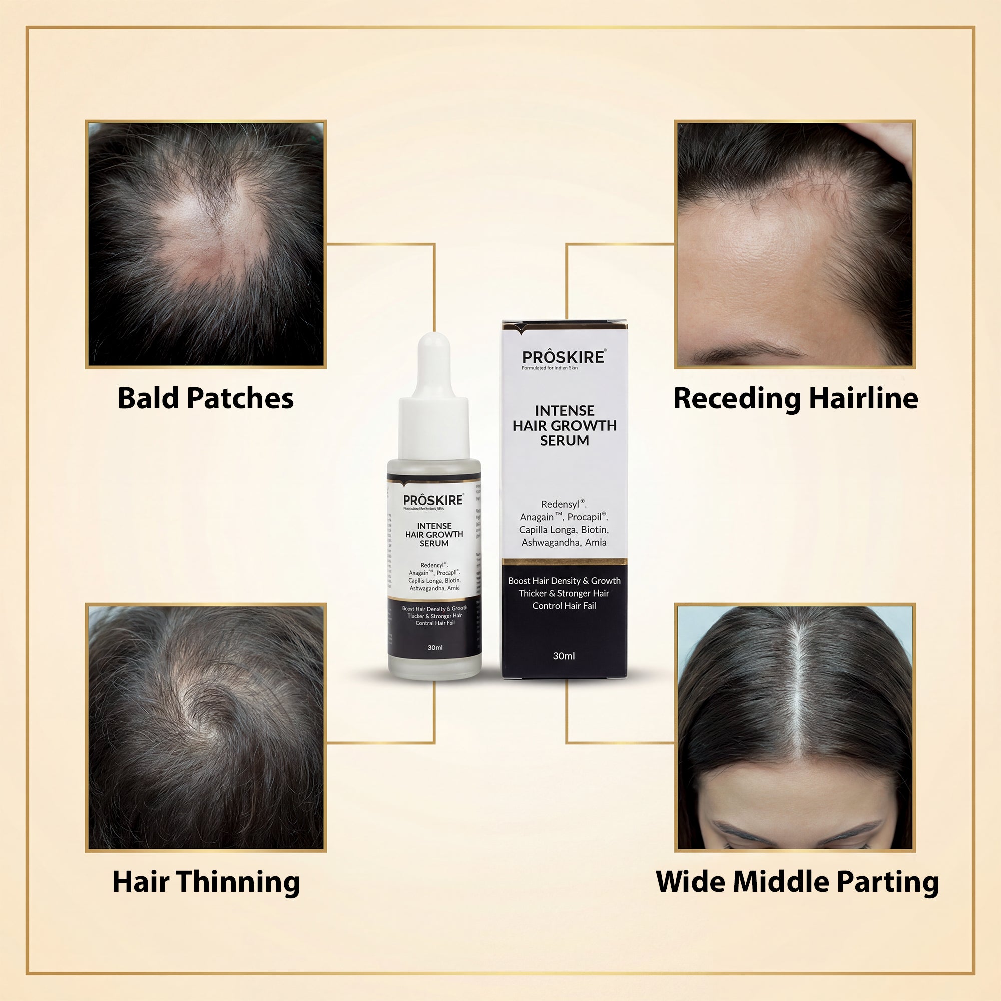 Hair Growth Serum Pack of 2 (30 ml Each) | Hair Fall Control & Regrowth Treatment
