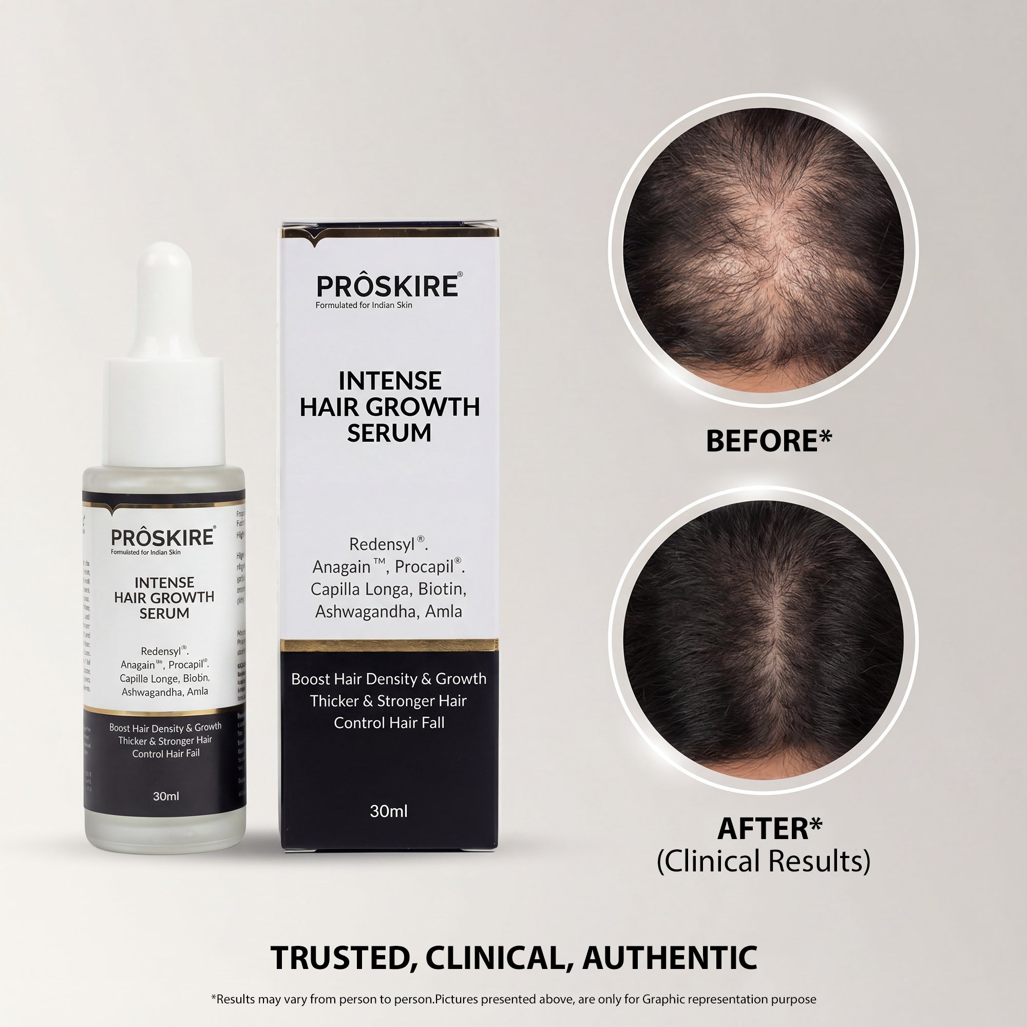 Hair Growth Serum Pack of 2 (30 ml Each) | Hair Fall Control & Regrowth Treatment