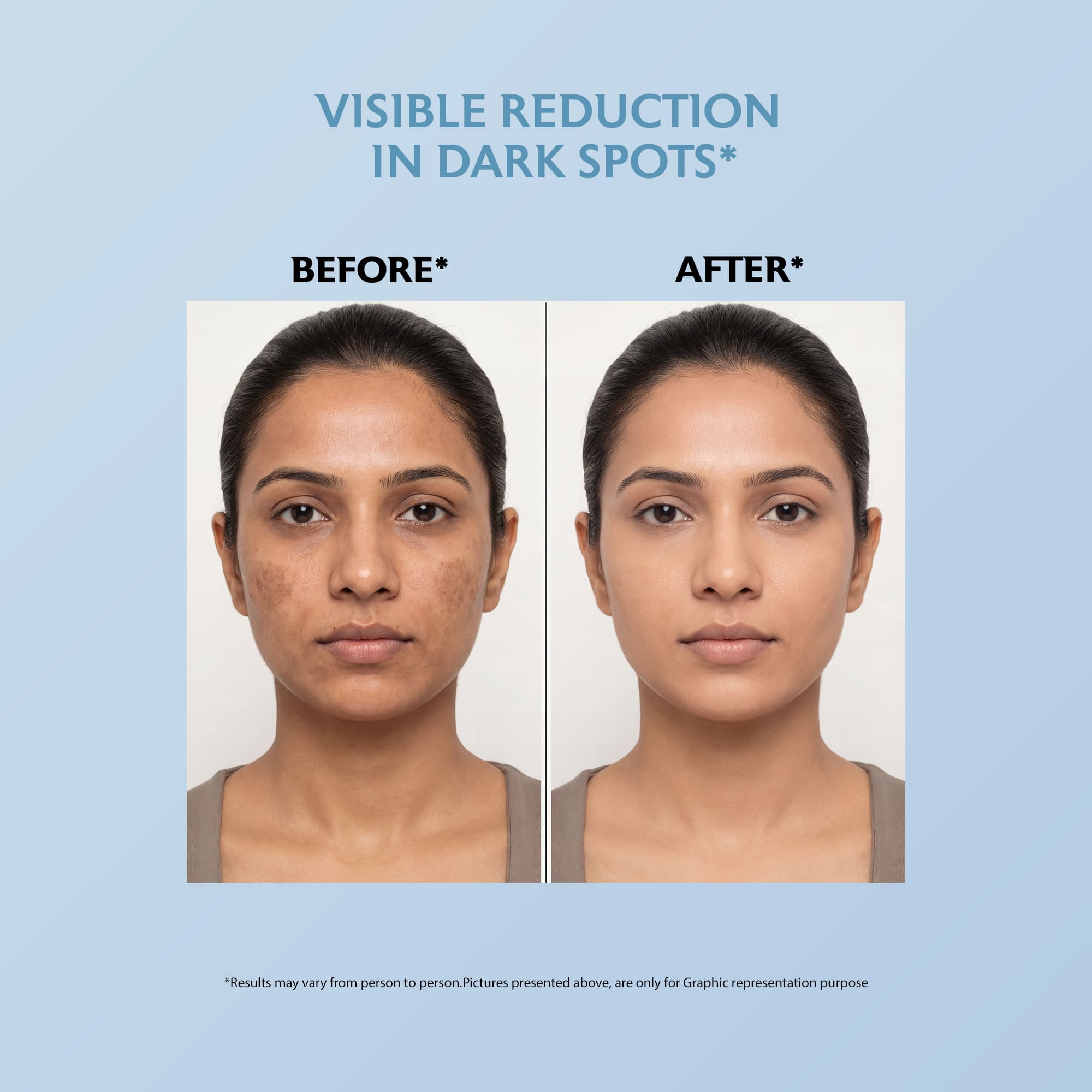 Kojic Acid Cream 50g