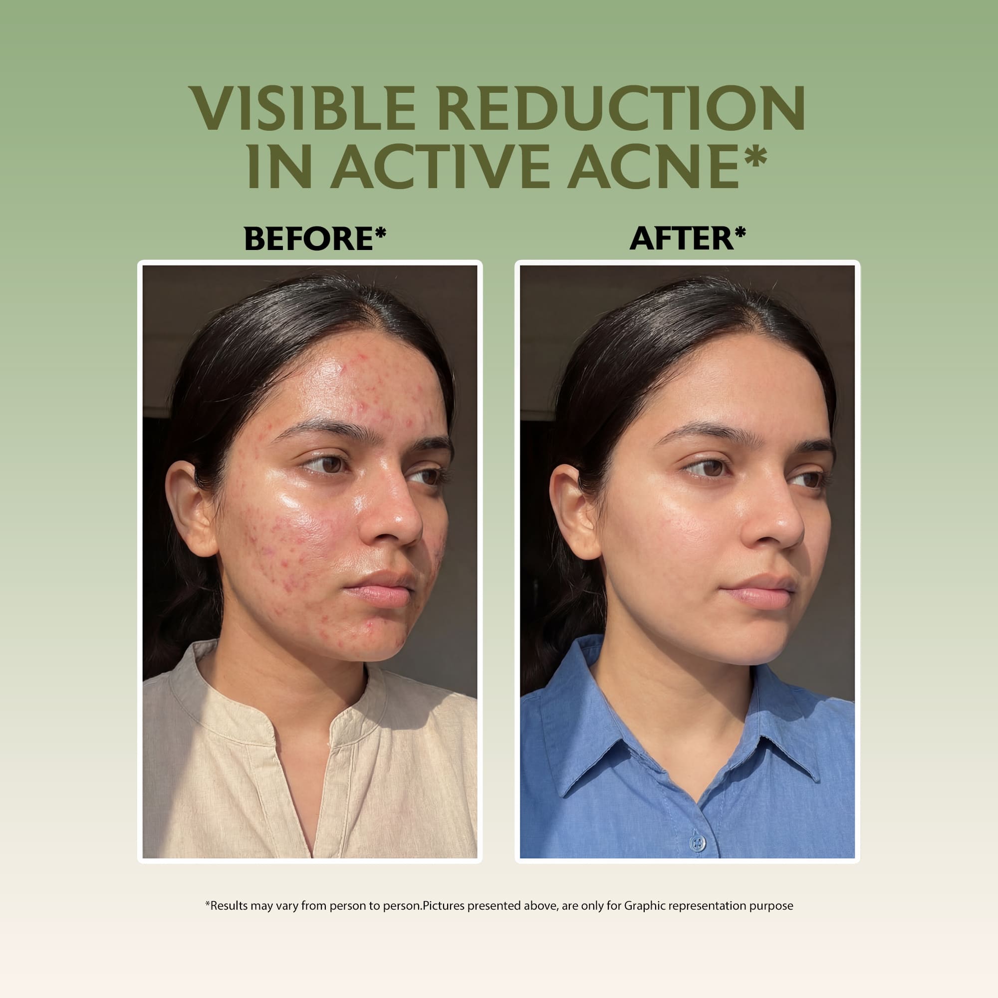 Salicylic Acid Serum 30ml