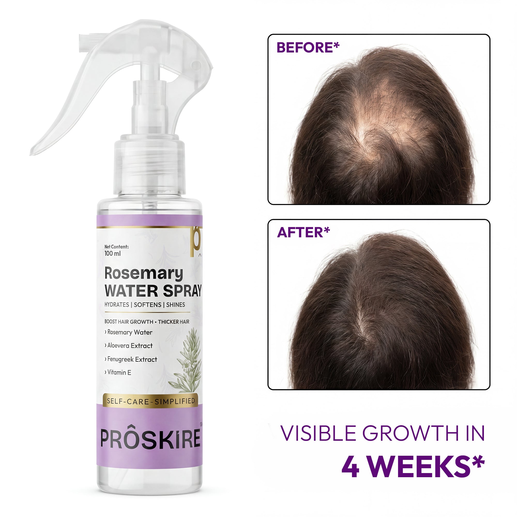 Proskire Rosemary Water Spray for Hair Growth | Hair Fall Control & Scalp Hydration | With Aloe Vera, Fenugreek & Vitamin E | Non-Greasy Leave-In Hair Mist for Thicker, Stronger Hair (100ml)