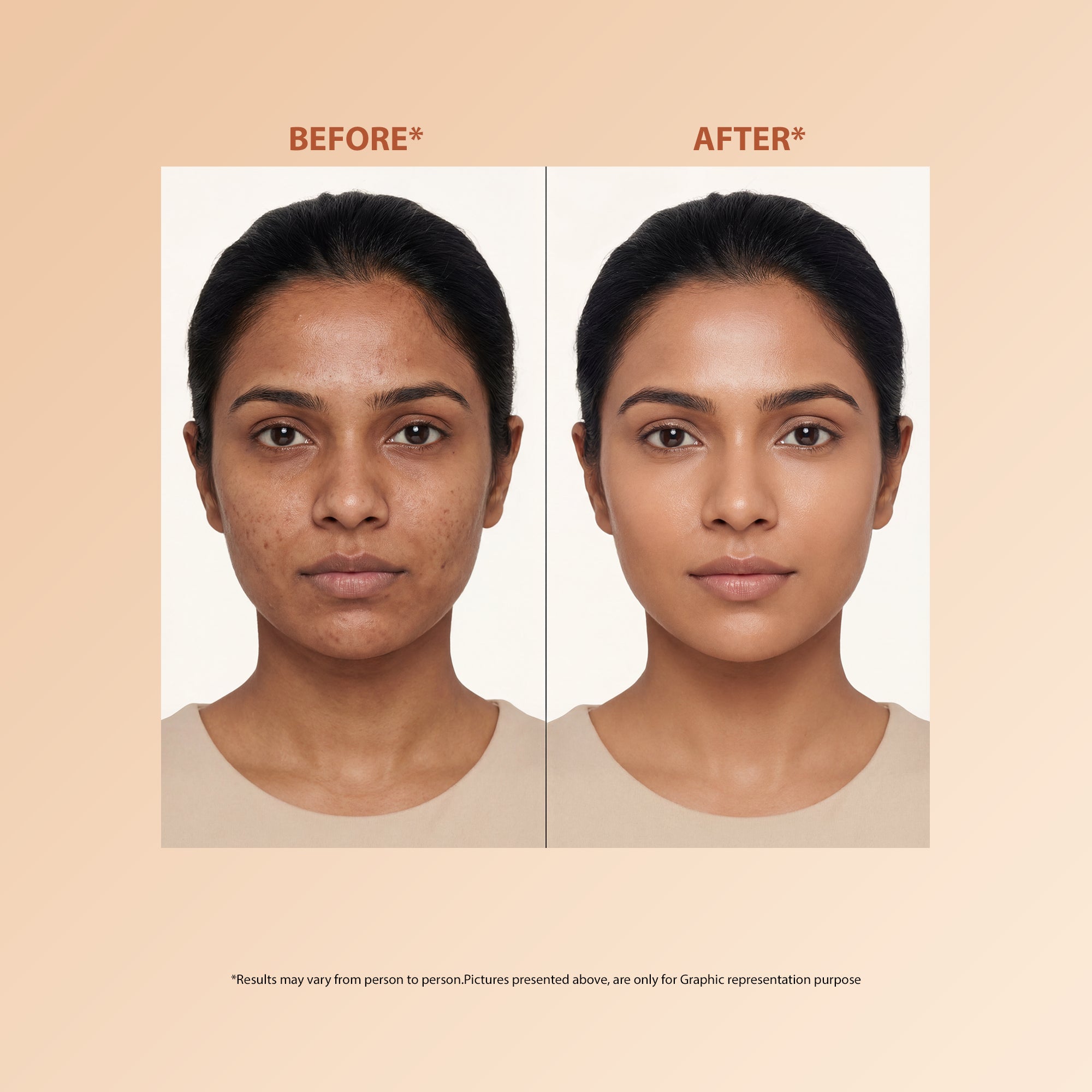 Niacinamide Serum 30ml