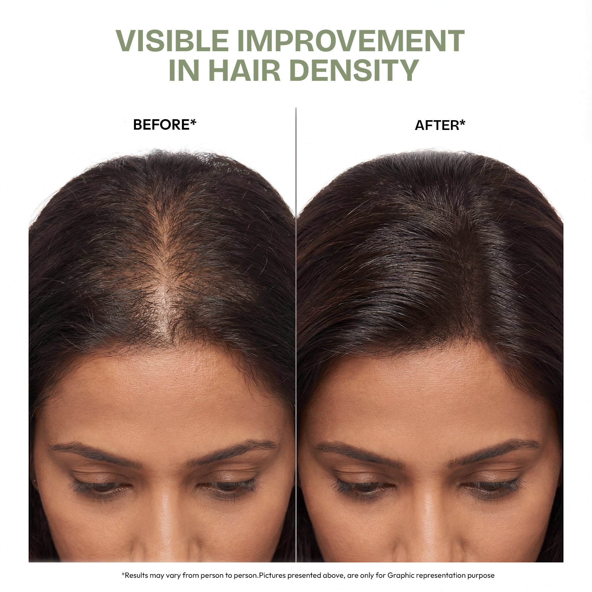 Ultimate Hair Growth Oil