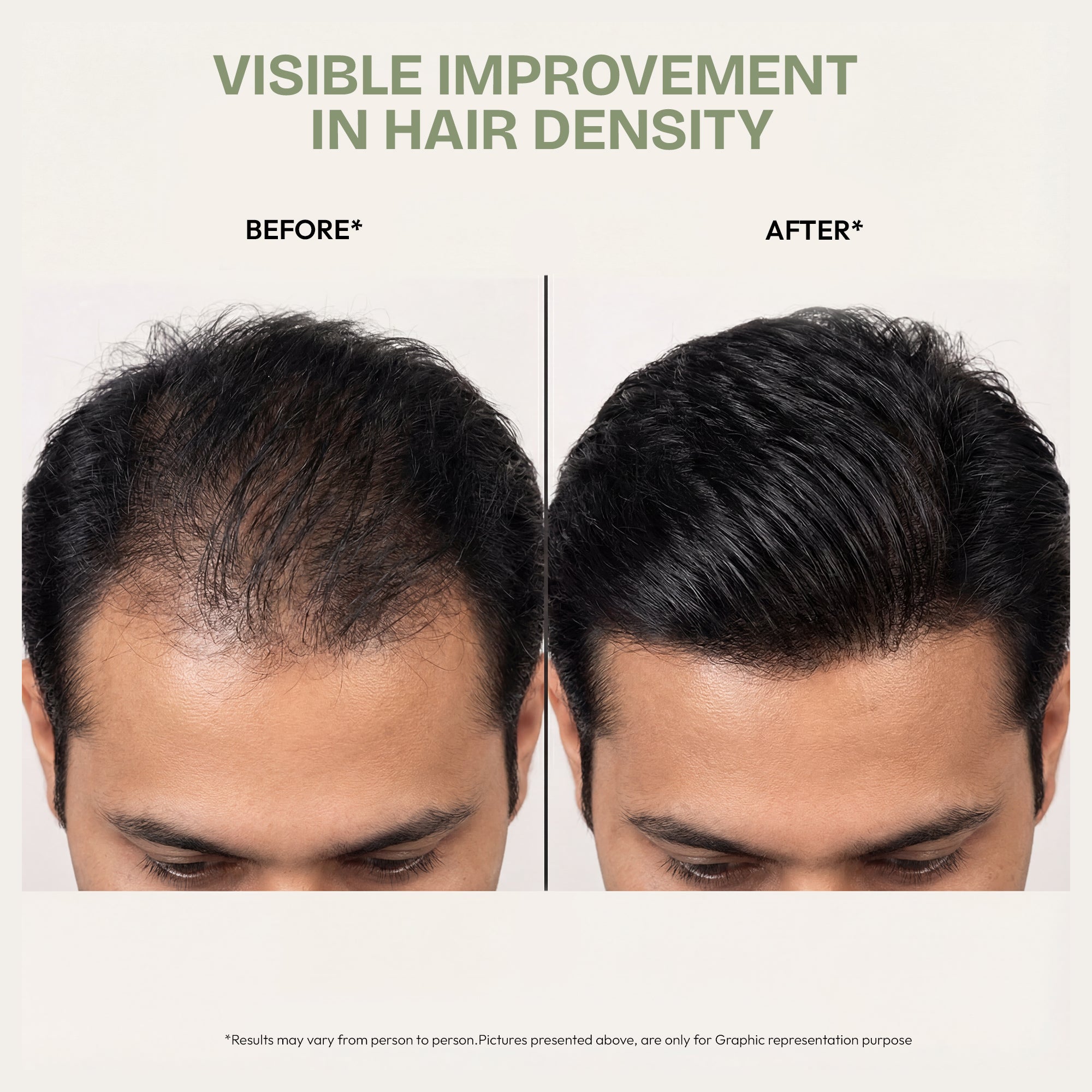 Ultimate Hair Growth Oil