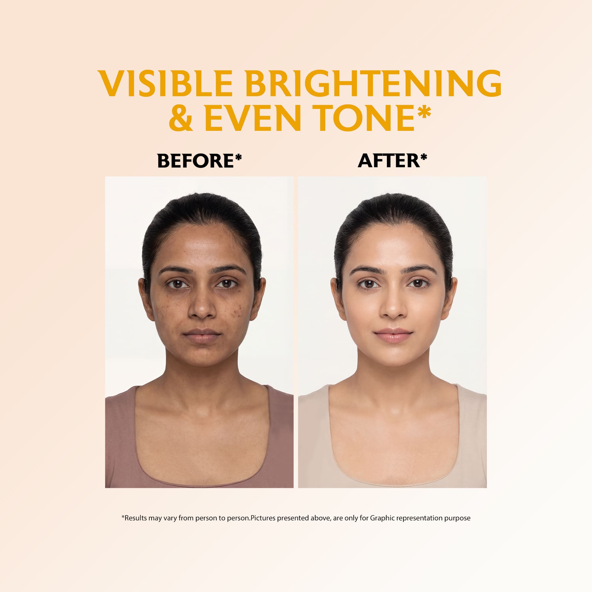 Vitamin C Brightening Cream For Dull, Uneven Skin Tone (50gm)