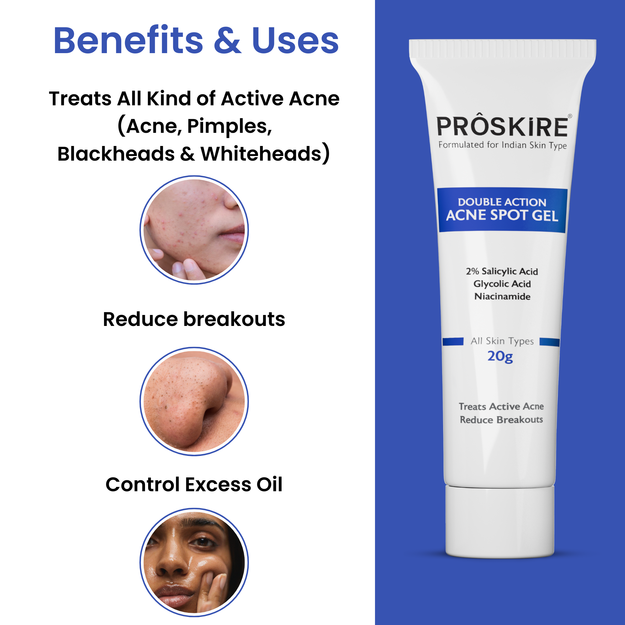 Proskire Double Action Acne Spot Gel Treatment for Acne & All Breakouts